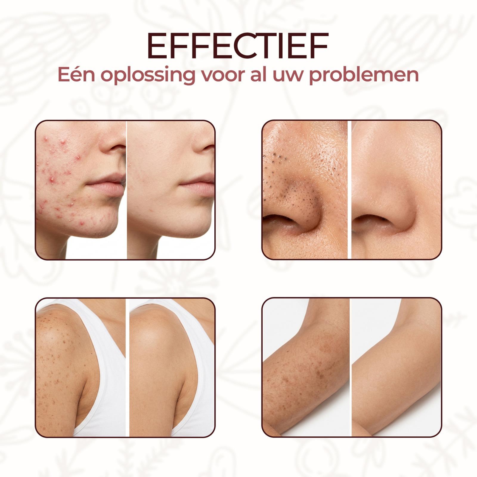 Pinky Posh® Kurkuma Zeep 2-Pack